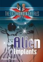Extraordinary Files: Alien Implants (Extraordinary Files Series)
