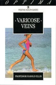 Varicose Veins (Positive Health Guide)