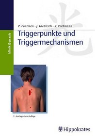 Triggerpunkte und Triggermechanismen.