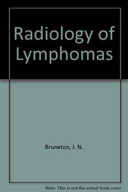Radiology of Lymphomas