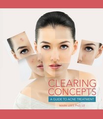 Clearing Concepts: A Guide to Acne Treatment (Conflict Resolution)