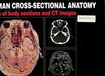 Human Cross-Sectional Anatomy: Atlas of Body Sections and Ct Images