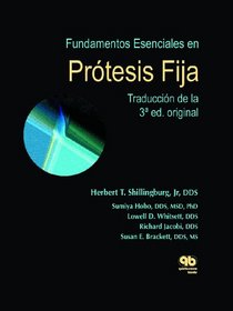 Fundamentos Esenciales en Prtesis Fija (Spanish Edition)