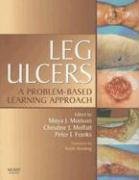 Leg Ulcers: A Problem-Based Learning Approach