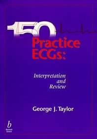 150 Practice ECG's: Interpretation and Board Review