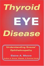Thyroid Eye Disease: Understanding Graves Ophthalmopathy