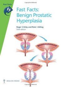 Benign Prostatic Hyperplasia (Fast Facts)
