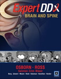 Expert Differential Diagnoses: Brain and Spine: Published by Amirsys