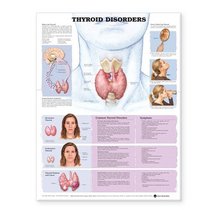 Thyroid Disorders Anatomical Chart