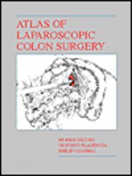 Atlas of Laparoscopic Colon Surgery (Books)