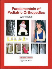 Fundmentals of Pediatric Orthopedics