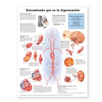 Understanding Hypertension Anatomical Chart in Spanish (Entendiendo Que Es la Hypertension)