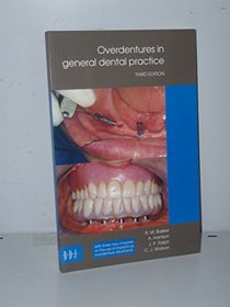 Overdentures in General Dental Practice