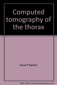 Computed tomography of the thorax