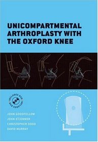 Unicompartmental Arthroplasty with the Oxford Knee (Oxford Medical Publications)