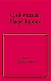Cardiovascular Plaque Rupture