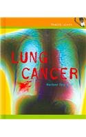 Lung Cancer (Health Alert)
