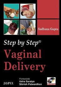 Step by Step Vaginal Delivery with DVD-ROM