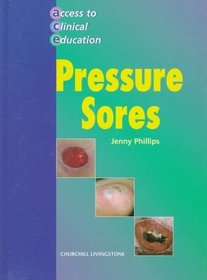 Pressure Sores (Access to Clinical Education)