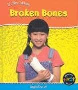 Broken Bones (Heinemann First Library)