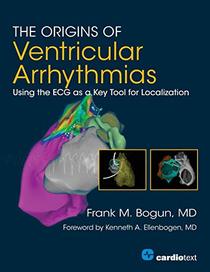 The Origins of Ventricular Arrhythmias: Using the ECG As a Key Tool for Localization