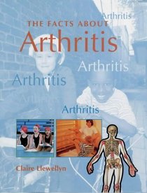 Arthritis (Facts About)