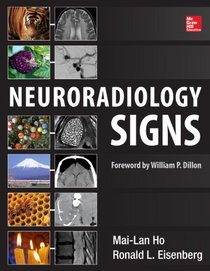 Neuroradiology Signs