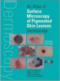 An Atlas of Surface Microscopy of Pigmented Skin Lesions : Dermoscopy,  Second Edition