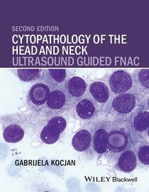 Cytopathology of the Head and Neck: Ultrasound Guided FNAC