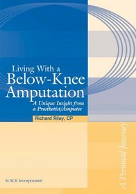 Living With A Below-Knee Amputation: A Unique Insight From A Prosthetist/Amputee