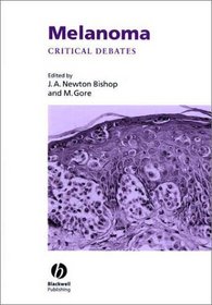 Melanoma: Critical Debates