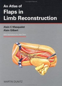 An Atlas of Flaps in Limb Reconstruction.