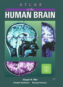 Atlas of the Human Brain, Deluxe Edition