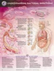 Understanding Bacterial Infections Anatomical Chart