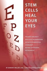 Stem Cells Heal Your Eyes: Prevent and Help: Macular Degeneration, Retinitis Pigmentosa, Stargardt, Retinal Distrophy, and Retinopathy.