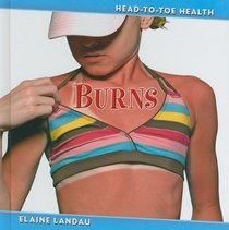Burns (Head-to-Toe Health 3)