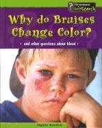 Why Do Bruises Change Color?: And Other Questions About Blood (Body Matters)