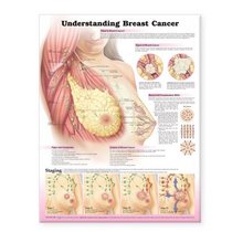 Understanding Breast Cancer