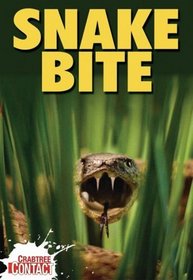 Snake Bite (Crabtree Contact)