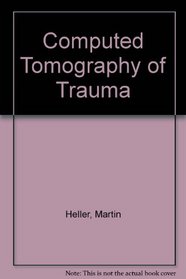 Computed Tomography of Trauma
