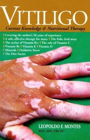 Vitiligo: Current Knowledge & Nutritional Therapy