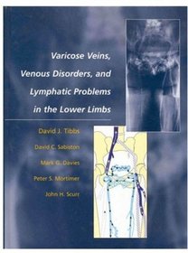 Varicose Veins, Venous Disorders, and Lymphatic Problems in the Lower Limbs