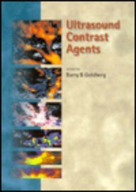 Ultrasound Contrast Agents