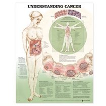 Understanding Cancer Anatomical Chart