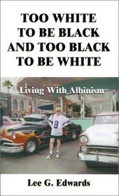 Too White to Be Black and Too Black to Be White: Living With Albinism