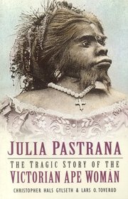 Julia Pastrana: The Tragic Story of the Victorian Ape Woman