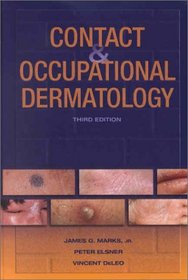 Contact  Occupational Dermatology