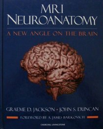MRI Neuroanatomy