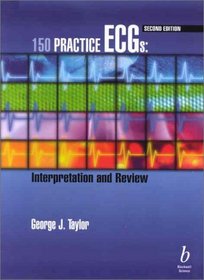 150 Practice ECGs: Interpretation and Review