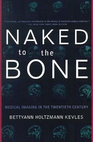 Naked to the Bone: Medical Imaging in the Twentieth Century